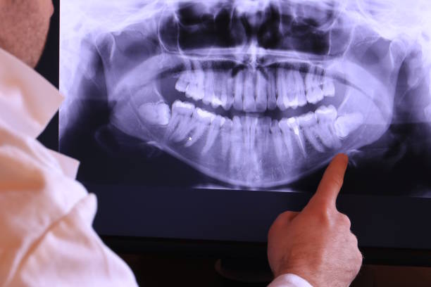Best Emergency Tooth Extraction in De Leon, TX